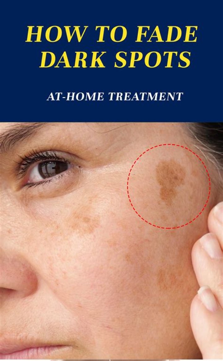 Does castor oil fade dark spots?